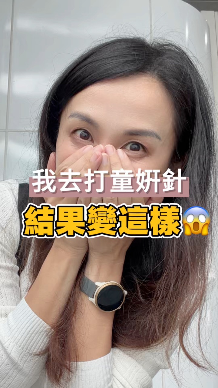 醫美療程